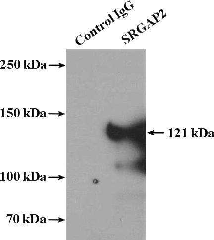 IP Result of anti-SRGAP2 (IP:Catalog No:115586, 4ug; Detection:Catalog No:115586 1:1000) with HEK-293 cells lysate 3000ug.
