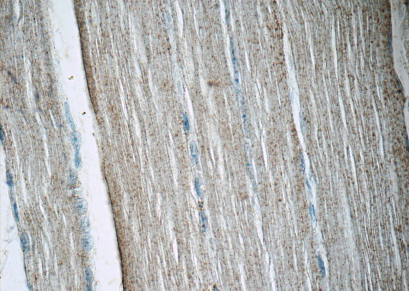Immunohistochemistry of paraffin-embedded human skeletal muscle tissue slide using Catalog No:108133(ANAPC11 Antibody) at dilution of 1:50(under 40x lens)