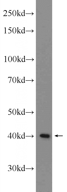 mouse liver tissue were subjected to SDS PAGE followed by western blot with Catalog No:116181(TMEM25 Antibody) at dilution of 1:1000