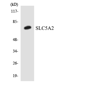 Fig1:; Western blot analysis of the lysates from Jurkat cells using SLC5A2 antibody.