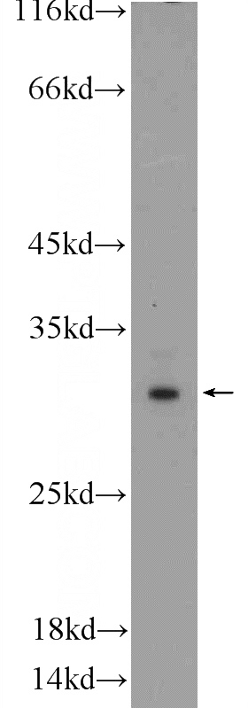 L02 cells were subjected to SDS PAGE followed by western blot with Catalog No:114221(PROSC Antibody) at dilution of 1:1000