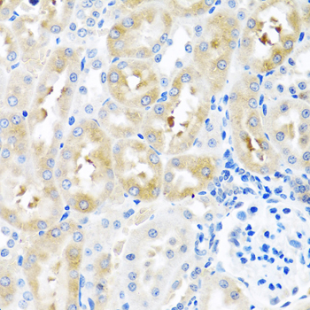 Immunohistochemistry - GNRH2 Polyclonal Antibody 