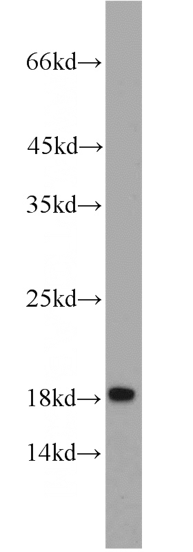 K-562 cells were subjected to SDS PAGE followed by western blot with Catalog No:111622(IFITM1 antibody) at dilution of 1:500