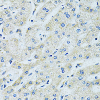 Immunohistochemistry - SLC5A6 Polyclonal Antibody 