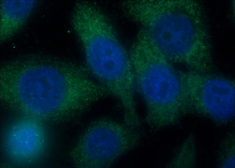 Immunofluorescent analysis of HeLa cells using Catalog No:115181(NSP1;SH2D3A Antibody) at dilution of 1:50 and Alexa Fluor 488-congugated AffiniPure Goat Anti-Rabbit IgG(H+L)