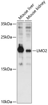 Western blot - LMO2 Polyclonal Antibody 
