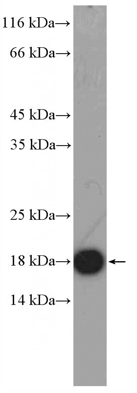 rat brain tissue were subjected to SDS PAGE followed by western blot with Catalog No:111099(GMFG Antibody) at dilution of 1:600