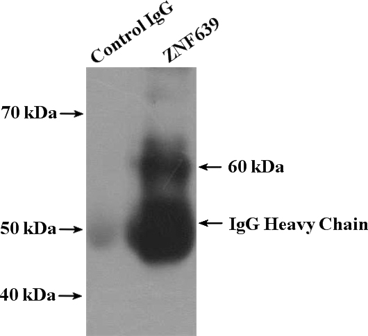 IP Result of anti-ZNF639 (IP:Catalog No:117014, 4ug; Detection:Catalog No:117014 1:300) with HeLa cells lysate 3960ug.
