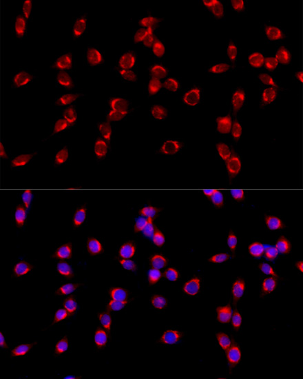 Immunofluorescence - COPB2 Polyclonal Antibody 
