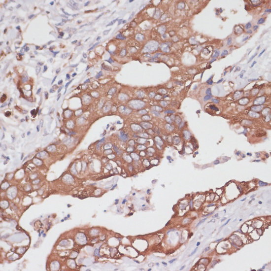 Immunohistochemistry - TPD52 Polyclonal Antibody 