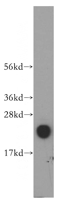 human liver tissue were subjected to SDS PAGE followed by western blot with Catalog No:110124(DUT antibody) at dilution of 1:800