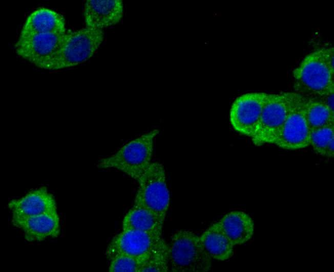 Fig1: ICC staining Plexin A1 in LOVO cells (green). The nuclear counter stain is DAPI (blue). Cells were fixed in paraformaldehyde, permeabilised with 0.25% Triton X100/PBS.
