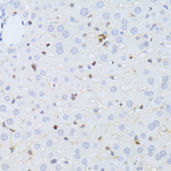 Immunohistochemistry - ZEB2 Polyclonal Antibody 