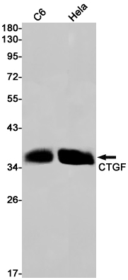 Anti-CTGF Rabbit antibody