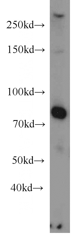 A431 cells were subjected to SDS PAGE followed by western blot with Catalog No:109122(GP1BA antibody) at dilution of 1:500