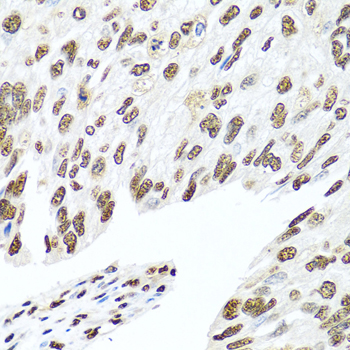 Immunohistochemistry - HNRNPR Polyclonal Antibody 