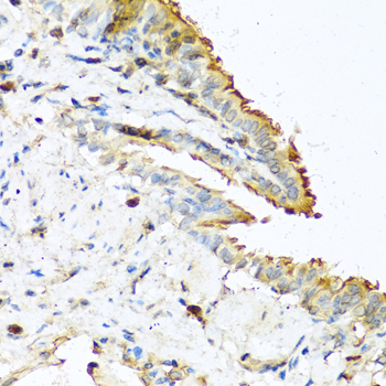 Immunohistochemistry - RNASE13 Polyclonal Antibody 