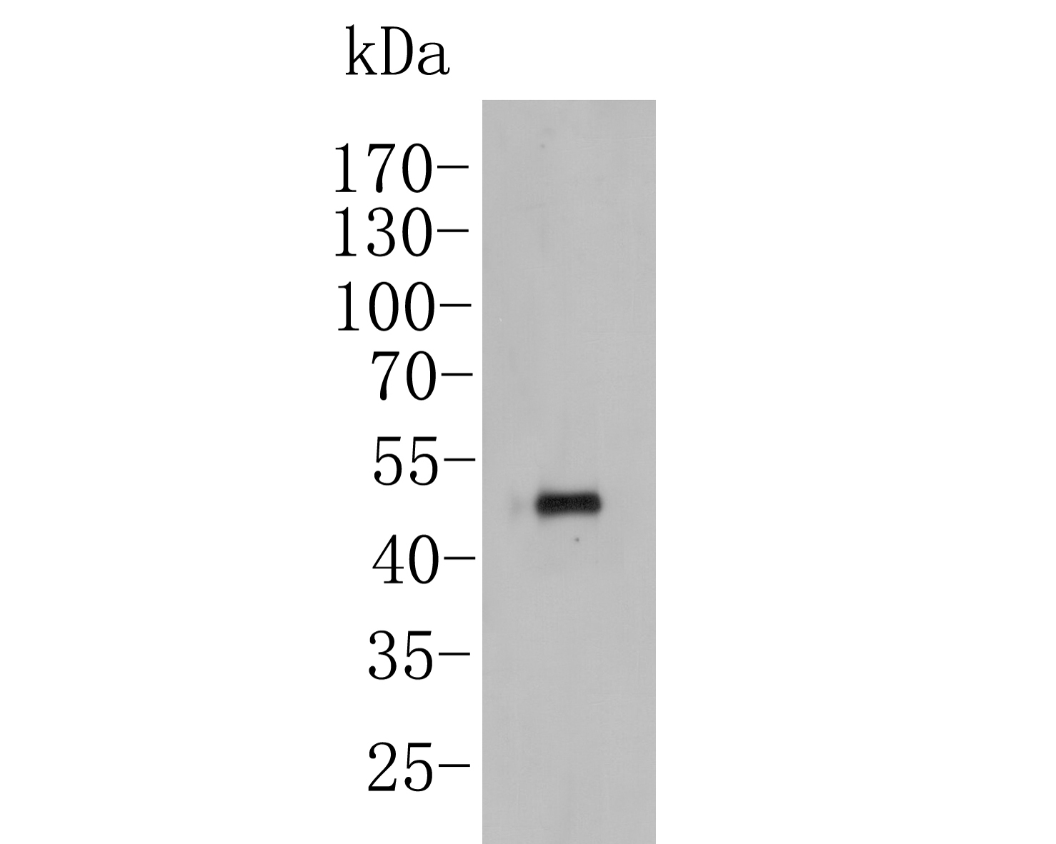 Fig1:; Western blot analysis of YKL-40 / CHI3L1 on THP-1 cell lysates. Proteins were transferred to a PVDF membrane and blocked with 5% BSA in PBS for 1 hour at room temperature. The primary antibody ( 1/500) was used in 5% BSA at room temperature for 2 hours. Goat Anti-Rabbit IgG - HRP Secondary Antibody (HA1001) at 1:5,000 dilution was used for 1 hour at room temperature.