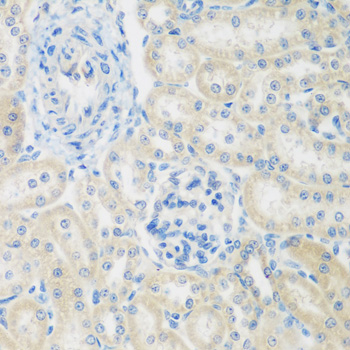 Immunohistochemistry - ENPEP Polyclonal Antibody 