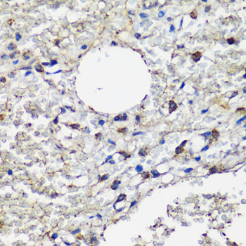 Immunohistochemistry - MRC1 Polyclonal Antibody 