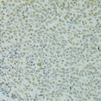 Immunohistochemistry - RCC1 Polyclonal Antibody 