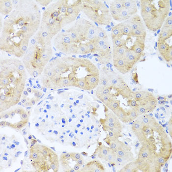 Immunohistochemistry - PDK3 Polyclonal Antibody 