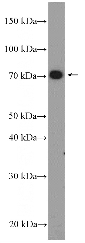 PC-3 cells were subjected to SDS PAGE followed by western blot with Catalog No:115744(SUPV3L1 Antibody) at dilution of 1:300
