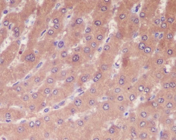 Immunohistochemical analysis of paraffin-embedded human liver, using Caspase-1 Antibody.
