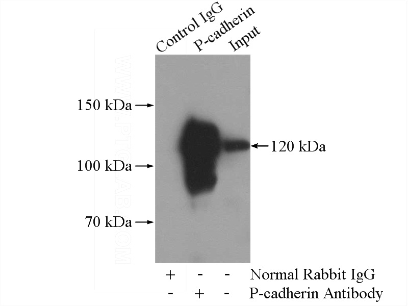 IP Result of anti-CDH3 (IP:Catalog No:113619, 4ug; Detection:Catalog No:113619 1:300) with A431 cells lysate 3040ug.