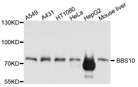Western blot - BBS10 Polyclonal Antibody 