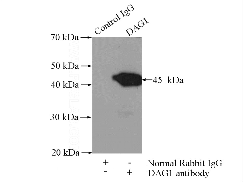 IP Result of anti-DAG1 (IP:Catalog No:110148, 4ug; Detection:Catalog No:110148 1:500) with mouse brain tissue lysate 2640ug.