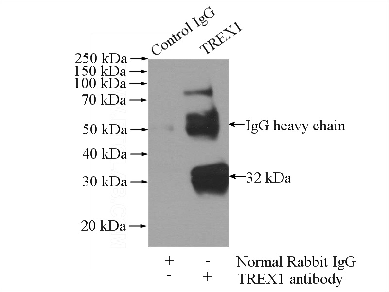 IP Result of anti-TREX1 (IP:Catalog No:116359, 4ug; Detection:Catalog No:116359 1:300) with HeLa cells lysate 1200ug.