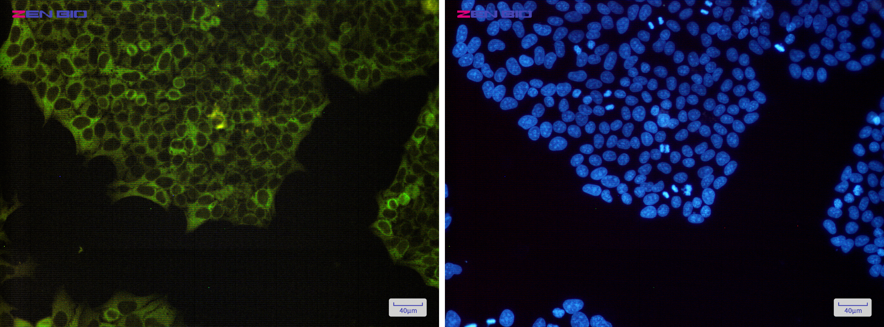 Immunocytochemistry of NFkB p100(green) in Hela cells using NFkB p100 Rabbit mAb at dilution 1/200, and DAPI(blue)