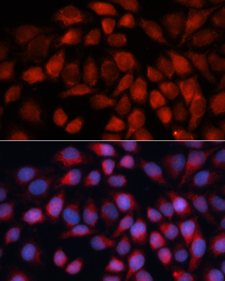 Immunofluorescence - ACADM Polyclonal Antibody 