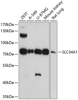 Western blot - SLC34A1 Polyclonal Antibody 