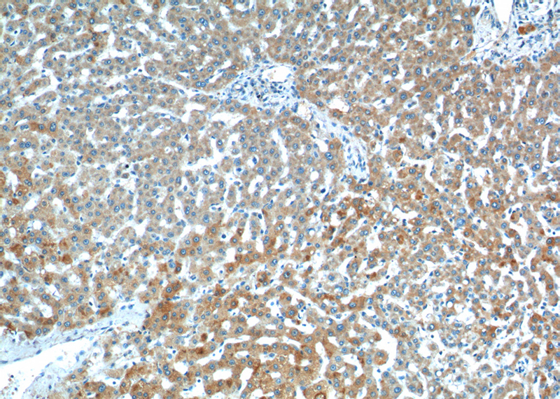 Immunohistochemistry of paraffin-embedded human liver tissue slide using Catalog No:116771(VPS13B Antibody) at dilution of 1:200 (under 10x lens).