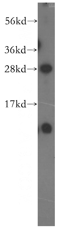 human brain tissue were subjected to SDS PAGE followed by western blot with Catalog No:113190(NIPSNAP3B antibody) at dilution of 1:1000