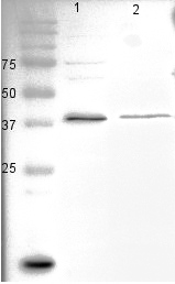WB results showed 37-42kd band in mouse 3T3-L1 adipocyte lysate(Lane 1) and human fat biopsy lysate (Lane 2) from Dr. Ping Wang.