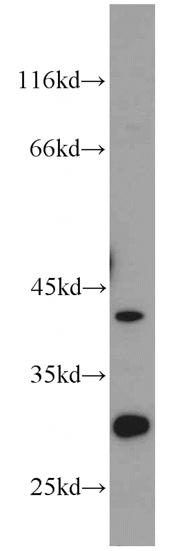 mouse brain tissue were subjected to SDS PAGE followed by western blot with Catalog No:115621(IL1RL1 antibody) at dilution of 1:1000