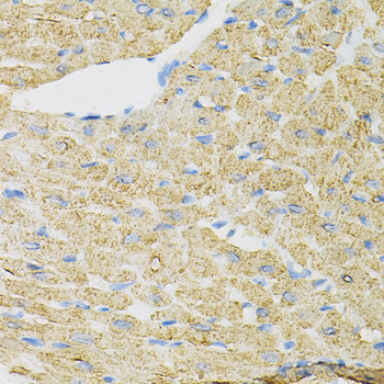 Immunohistochemistry - INPP5J Polyclonal Antibody 