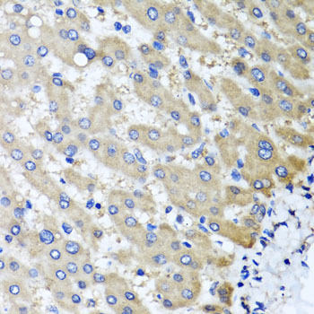 Immunohistochemistry - RBP2 Polyclonal Antibody 