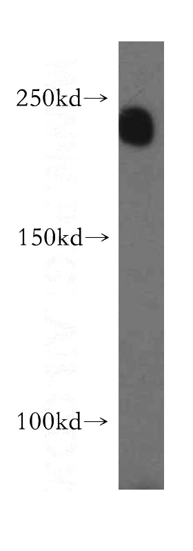 human testis tissue were subjected to SDS PAGE followed by western blot with Catalog No:112360(LTBP2 antibody) at dilution of 1:500