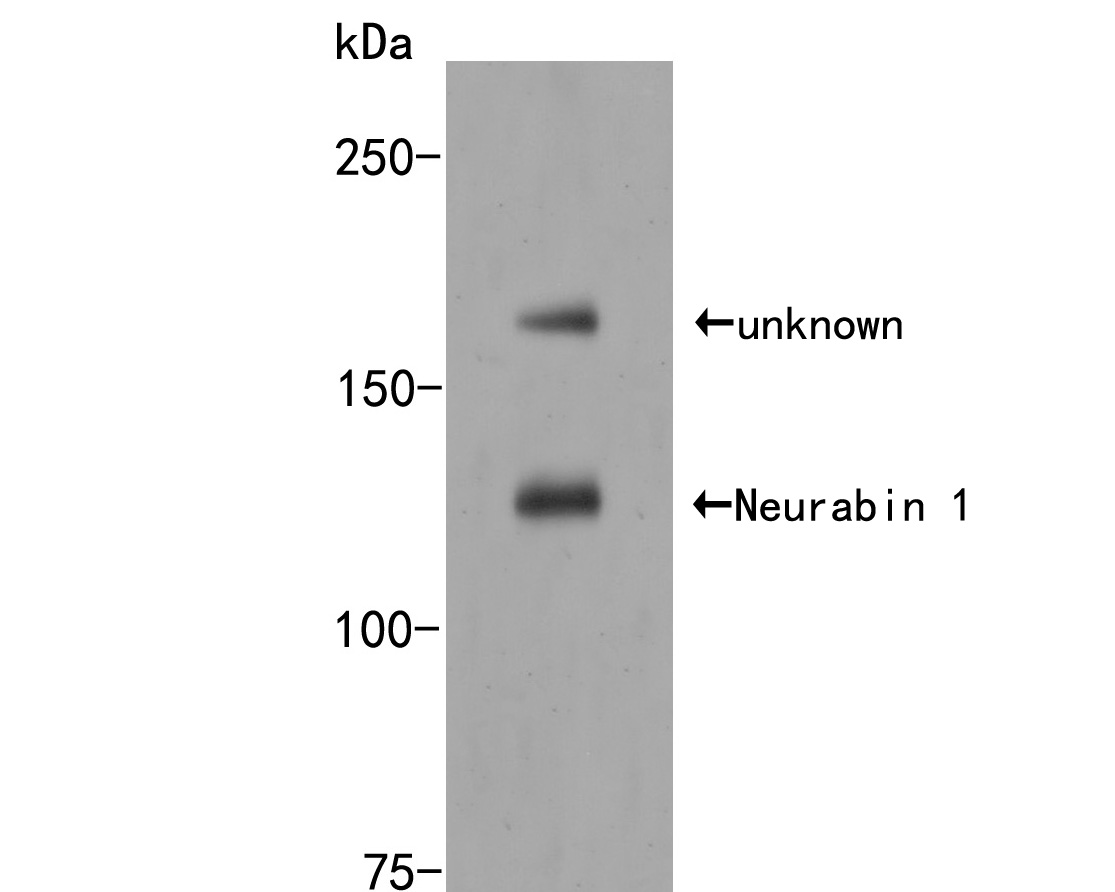 Fig1:; Western blot analysis of Neurabin 1 on rat brain tissue lysates. Proteins were transferred to a PVDF membrane and blocked with 5% BSA in PBS for 1 hour at room temperature. The primary antibody ( 1/500) was used in 5% BSA at room temperature for 2 hours. Goat Anti-Rabbit IgG - HRP Secondary Antibody (HA1001) at 1:5,000 dilution was used for 1 hour at room temperature.