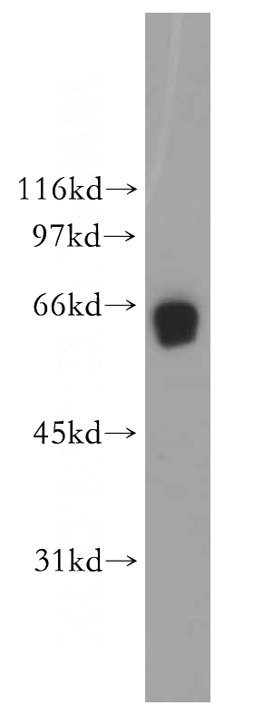 human cerebellum tissue were subjected to SDS PAGE followed by western blot with Catalog No:108922(CAMK4 antibody) at dilution of 1:400