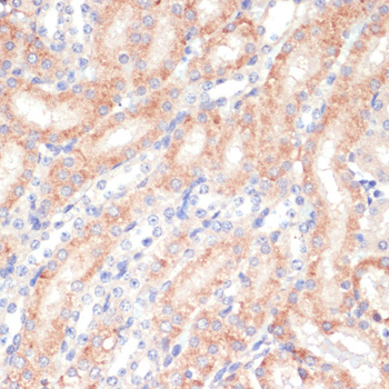 Immunohistochemistry - WNT5B Polyclonal Antibody 