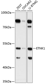 Western blot - ETNK1 Polyclonal Antibody 