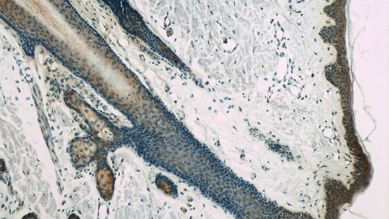 Immunohistochemistry of paraffin-embedded human skin slide using Catalog No:117109(BCR Antibody) at dilution of 1:50