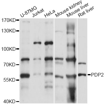 Western blot - PDP2 Polyclonal Antibody 