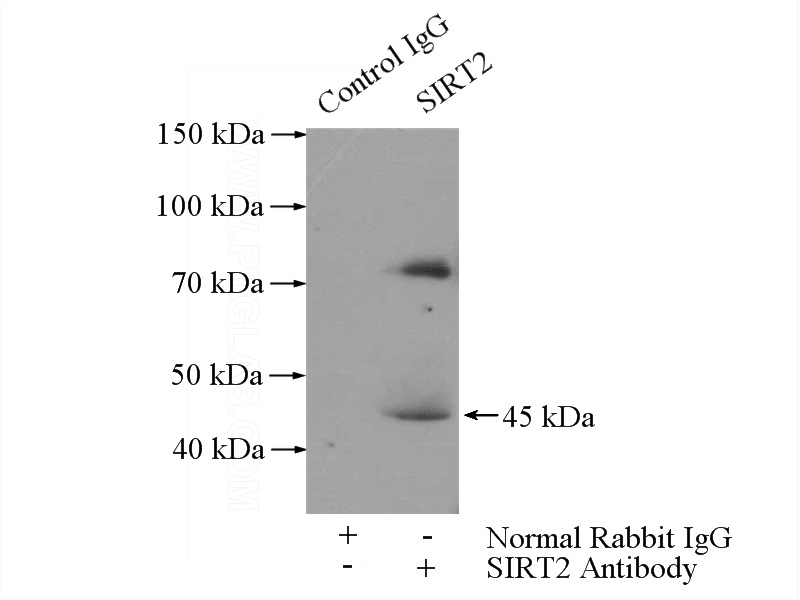 IP Result of anti-SIRT2 (IP:Catalog No:115242, 4ug; Detection:Catalog No:115242 1:500) with mouse brain tissue lysate 4000ug.
