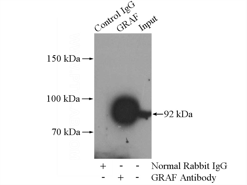 IP Result of anti-ARHGAP26 (IP:Catalog No:111154, 4ug; Detection:Catalog No:111154 1:1000) with HepG2 cells lysate 3600ug.